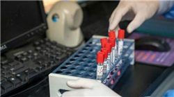 锂电“反内卷”显成效？六氟磷酸锂涨价潮袭来 业内：厂商前期主动降负荷